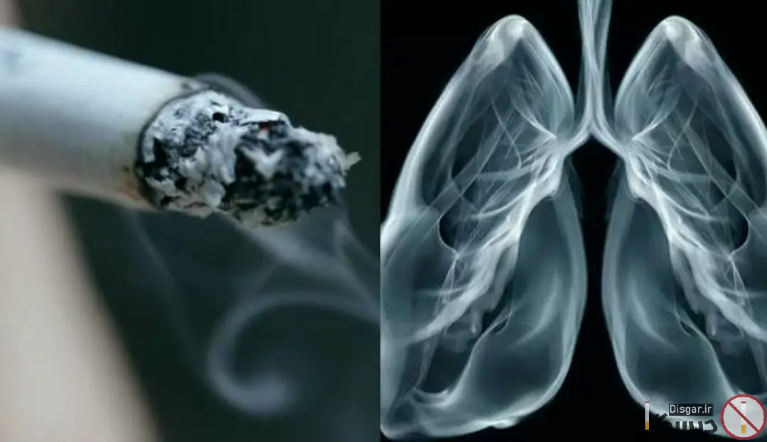 علائم سرطان ریه در افراد سیگاری