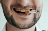 زردی دندان بخاطر کشیدن سیگار حقیقت دارد؟